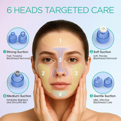 Blackhead Remover Pore Vacuum - Electric Face Cleaner with 6 Suction Heads