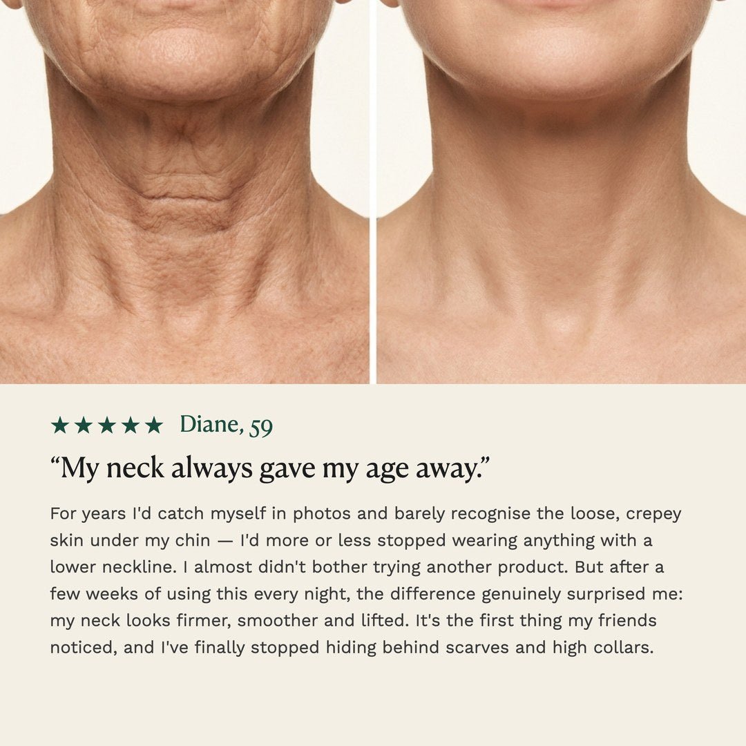 Overnight Firming Oil neck comparison and customer testimonial