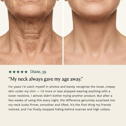 Overnight Firming Oil neck comparison and customer testimonial