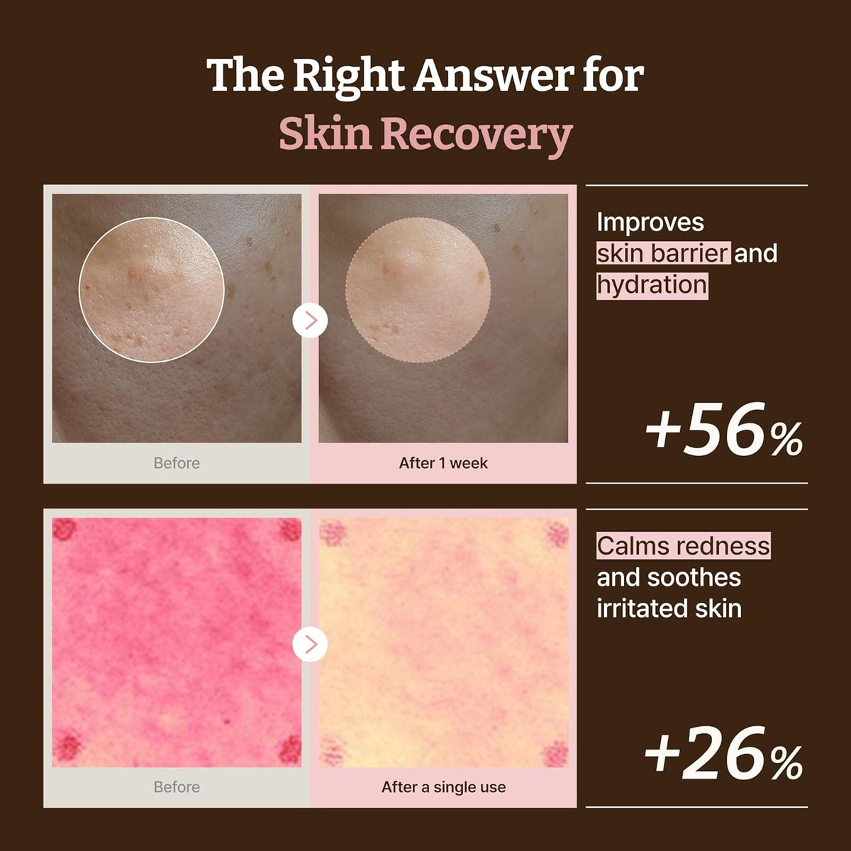 Advanced PDRN Rejuvenating Cream Max - 99% Pure Salmon DNA Gel Moisturizer for Glass Skin