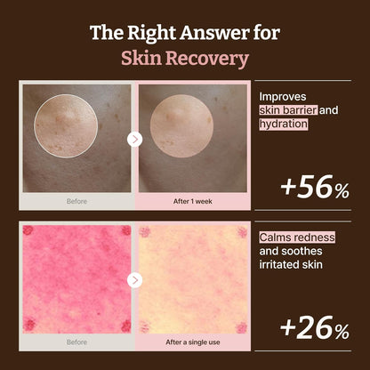 Advanced PDRN Rejuvenating Cream Max - 99% Pure Salmon DNA Gel Moisturizer for Glass Skin